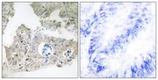 FSP27 / CIDEC Antibody - Peptide - + Immunohistochemistry analysis of paraffin-embedded human colon carcinoma tissue using CIDEC antibody.
