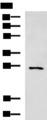 FSP27 / CIDEC Antibody - Western blot analysis of Mouse small intestines tissue lysate  using CIDEC Polyclonal Antibody at dilution of 1:400