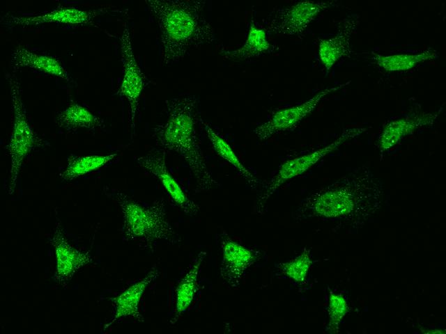 FSP27 / CIDEC Antibody - Immunofluorescence staining of CIDEC in HeLa cells. Cells were fixed with 4% PFA, permeabilzed with 0.1% Triton X-100 in PBS, blocked with 10% serum, and incubated with rabbit anti-Human CIDEC polyclonal antibody (dilution ratio 1:1000) at 4°C overnight. Then cells were stained with the Alexa Fluor 488-conjugated Goat Anti-rabbit IgG secondary antibody (green). Positive staining was localized to nucleus and cytoplasm.
