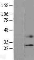 FSP27 / CIDEC Protein - Western validation with an anti-DDK antibody * L: Control HEK293 lysate R: Over-expression lysate