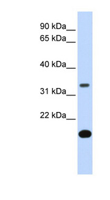 FST / Follistatin Antibody - FST / Follistatin antibody Western blot of Fetal Heart lysate. This image was taken for the unconjugated form of this product. Other forms have not been tested.