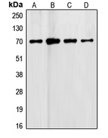 FST / Follistatin Antibody - Western blot analysis of Follistatin expression in HeLa (A); C6 (B); HepG2 (C); Jurkat (D) whole cell lysates.