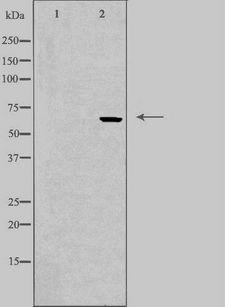 FST / Follistatin Antibody - Western blot analysis of extracts of HepG2 cells using FST antibody. The lane on the left is treated with the antigen-specific peptide.