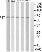 FST / Follistatin Antibody - Western blot analysis of extracts from HepG2, K562, COLO205, Jurkat and HeLa cells, using FST antibody.