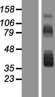 FST / Follistatin Protein - Western validation with an anti-DDK antibody * L: Control HEK293 lysate R: Over-expression lysate
