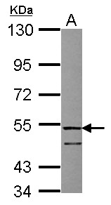 FSTL1 Antibody - Sample (30 ug of whole cell lysate) A: Raji 10% SDS PAGE FSTL1 antibody diluted at 1:1000