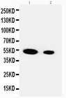 FSTL3 / FLRG Antibody - WB of FSTL3 / FLRG antibody. Recombinant Protein Detection Source:. E.coli derived -recombinant Human FSTL3, 39.2KD. (162aa tag+ L52-P251). Lane 1: Recombinant Human FSTL3 Protein 10ng. Lane 2: Recombinant Human FSTL3 Protein 5ng.