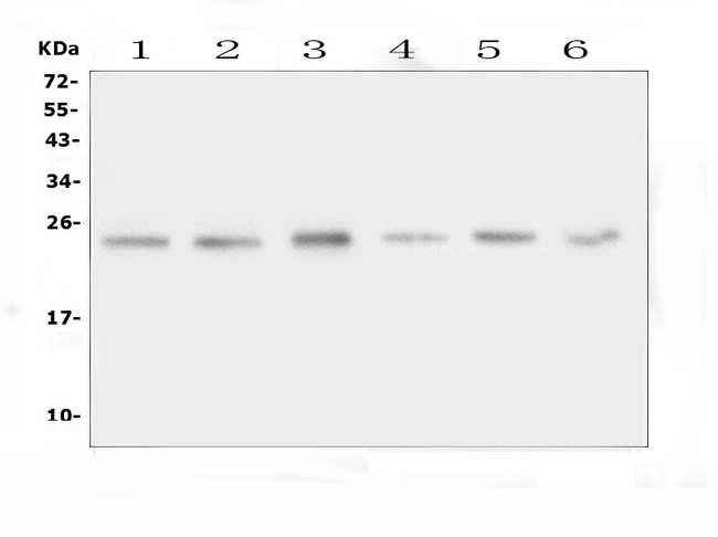 FSTL3 / FLRG Antibody - Western blot analysis of FSTL3 using anti-FSTL3 antibody. Electrophoresis was performed on a 5-20% SDS-PAGE gel at 70V (Stacking gel) / 90V (Resolving gel) for 2-3 hours. The sample well of each lane was loaded with 50ug of sample under reducing conditions. Lane 1: rat liver tissue lysates, Lane 2: rat testis tissue lysates, Lane 3: rat NRK whole cell lysates, Lane 4: mouse liver tissue lysates, Lane 5: mouse testis tissue lysates, Lane 6: mouse lung tissue lysates. After Electrophoresis, proteins were transferred to a Nitrocellulose membrane at 150mA for 50-90 minutes. Blocked the membrane with 5% Non-fat Milk/ TBS for 1.5 hour at RT. The membrane was incubated with rabbit anti-FSTL3 antigen affinity purified polyclonal antibody at 0.5 µg/mL overnight at 4°C, then washed with TBS-0.1% Tween 3 times with 5 minutes each and probed with a goat anti-rabbit IgG-HRP secondary antibody at a dilution of 1:10000 for 1.5 hour at RT. The signal is developed using an Enhanced Chemiluminescent detection (ECL) kit with Tanon 5200 system. A specific band was detected for FSTL3 at approximately 22-24KD. The expected band size for FSTL3 is at 22KD.