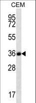 FSTL3 / FLRG Antibody - FSTL3 Antibody western blot of CEM cell line lysates (35 ug/lane). The FSTL3 antibody detected the FSTL3 protein (arrow).