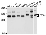 FSTL3 / FLRG Antibody - Western blot analysis of extracts of various cell lines, using FSTL3 antibody at 1:1000 dilution. The secondary antibody used was an HRP Goat Anti-Rabbit IgG (H+L) at 1:10000 dilution. Lysates were loaded 25ug per lane and 3% nonfat dry milk in TBST was used for blocking. An ECL Kit was used for detection and the exposure time was 60s.