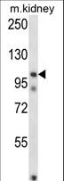 FSTL5 Antibody - FSTL5 Antibody western blot of mouse kidney tissue lysates (35 ug/lane). The FSTL5 antibody detected the FSTL5 protein (arrow).