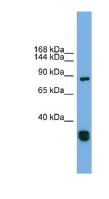 FSTL5 Antibody - FSTL5 antibody Western blot of Fetal Heart lysate. This image was taken for the unconjugated form of this product. Other forms have not been tested.