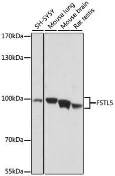 FSTL5 Antibody - Western blot analysis of extracts of various cell lines using FSTL5 Polyclonal Antibody at dilution of 1:1000.