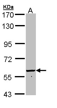 FTCD / 58K Golgi Protein Antibody - Sample (30 ug of whole cell lysate). A: Hep G2 . 7.5% SDS PAGE. 58K Golgi Protein / FTCD antibody diluted at 1:1000