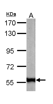 FTCD / 58K Golgi Protein Antibody - Sample (50 ug of whole cell lysate). A: mouse liver. 7.5% SDS PAGE. 58K Golgi Protein / FTCD antibody diluted at 1:1000.