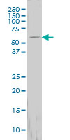 FTCD / 58K Golgi Protein Antibody - FTCD monoclonal antibody (M01), clone 3A4 Western blot of FTCD expression in HepG2.