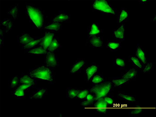 FTCD / 58K Golgi Protein Antibody - Immunofluorescence of monoclonal antibody to FTCD on HepG2 cell. [antibody concentration 10 ug/ml]