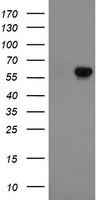 FTCD / 58K Golgi Protein Antibody - HEK293T cells were transfected with the pCMV6-ENTRY control (Left lane) or pCMV6-ENTRY FTCD (Right lane) cDNA for 48 hrs and lysed. Equivalent amounts of cell lysates (5 ug per lane) were separated by SDS-PAGE and immunoblotted with anti-FTCD.