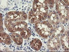 FTCD / 58K Golgi Protein Antibody - IHC of paraffin-embedded Human Kidney tissue using anti-FTCD mouse monoclonal antibody.