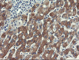 FTCD / 58K Golgi Protein Antibody - IHC of paraffin-embedded Human liver tissue using anti-FTCD mouse monoclonal antibody.