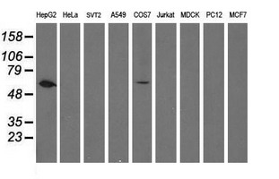 FTCD / 58K Golgi Protein Antibody - Western blot of extracts (35 ug) from 9 different cell lines by using anti-FTCD monoclonal antibody (HepG2: human; HeLa: human; SVT2: mouse; A549: human; COS7: monkey; Jurkat: human; MDCK: canine; PC12: rat; MCF7: human).