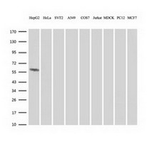 FTCD / 58K Golgi Protein Antibody - Western blot of extracts (35 ug) from 9 different cell lines by using g anti-FTCD monoclonal antibody (HepG2: human; HeLa: human; SVT2: mouse; A549: human; COS7: monkey; Jurkat: human; MDCK: canine; PC12: rat; MCF7: human).