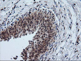 FTCD / 58K Golgi Protein Antibody - IHC of paraffin-embedded Human bladder tissue using anti-FTCD mouse monoclonal antibody.