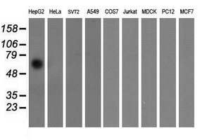 FTCD / 58K Golgi Protein Antibody - Western blot of extracts (35 ug) from 9 different cell lines by using anti-FTCD monoclonal antibody (HepG2: human; HeLa: human; SVT2: mouse; A549: human; COS7: monkey; Jurkat: human; MDCK: canine; PC12: rat; MCF7: human).