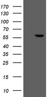 FTCD / 58K Golgi Protein Antibody - HEK293T cells were transfected with the pCMV6-ENTRY control (Left lane) or pCMV6-ENTRY FTCD (Right lane) cDNA for 48 hrs and lysed. Equivalent amounts of cell lysates (5 ug per lane) were separated by SDS-PAGE and immunoblotted with anti-FTCD.