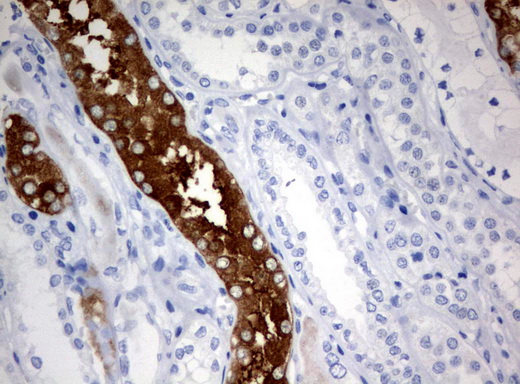 FTCD / 58K Golgi Protein Antibody - Immunohistochemical staining of paraffin-embedded Human Kidney tissue using anti-FTCD mouse monoclonal antibody.  heat-induced epitope retrieval by 10mM citric buffer, pH6.0, 120C for 3min)