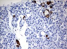 FTCD / 58K Golgi Protein Antibody - Immunohistochemical staining of paraffin-embedded Human pancreas tissue using anti-FTCD mouse monoclonal antibody.  heat-induced epitope retrieval by 10mM citric buffer, pH6.0, 120C for 3min)
