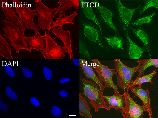 FTCD / 58K Golgi Protein Antibody - Immunofluorescent staining of HeLa cells using anti-FTCD mouse monoclonal antibody  green, 1:50). Actin filaments were labeled with Alexa Fluor® 594 Phalloidin. (red), and nuclear with DAPI. (blue). Scale bar, 25µm.