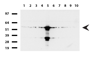 FTCD / 58K Golgi Protein Antibody - Western blot of human tissue lysates. (15ug) from 10 different tissues. (1: Testis, 2: Omentum, 3: Uterus, 4: Breast, 5: Brain, 6: Liver, 7: Ovary, 8: Thyroid, 9: Colon, 10: Spleen ). Diluation: 1:500.