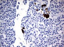 FTCD / 58K Golgi Protein Antibody - Immunohistochemical staining of paraffin-embedded Human pancreas tissue using anti-FTCD mouse monoclonal antibody.  heat-induced epitope retrieval by 10mM citric buffer, pH6.0, 120C for 3min)
