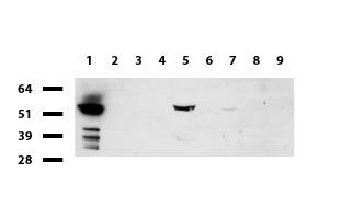 FTCD / 58K Golgi Protein Antibody - Western blot of cell lysates. (35ug) from 9 different cell lines. (1: HepG2, 2: HeLa, 3: SV-T2, 4: A549, 5: COS7, 6: Jurkat, 7: MDCK, 8: PC-12, 9: MCF7). Diluation: 1:500