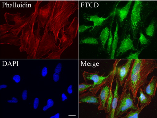 FTCD / 58K Golgi Protein Antibody - Immunofluorescent staining of HeLa cells using anti-FTCD mouse monoclonal antibody  green, 1:50). Actin filaments were labeled with Alexa Fluor® 594 Phalloidin. (red), and nuclear with DAPI. (blue). Scale bar, 20µm.
