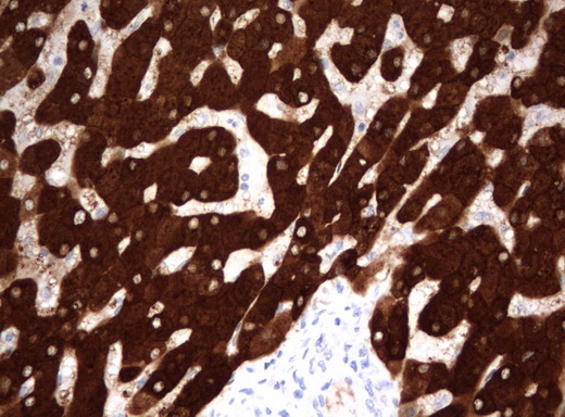 FTCD / 58K Golgi Protein Antibody - Immunohistochemical staining of paraffin-embedded Human liver tissue using anti-FTCD mouse monoclonal antibody.  heat-induced epitope retrieval by 10mM citric buffer, pH6.0, 120C for 3min)