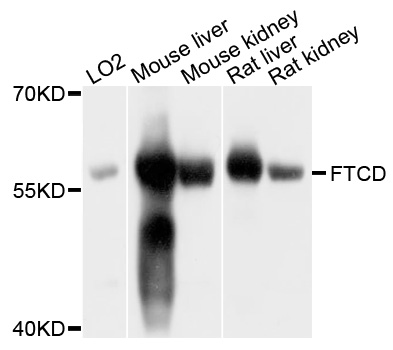 FTCD / 58K Golgi Protein Antibody - Western blot analysis of extract of various cells.
