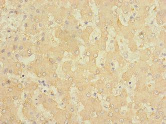 FTCD / 58K Golgi Protein Antibody - Immunohistochemistry of paraffin-embedded human liver tissue at dilution 1:100