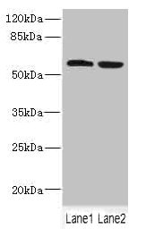 FTCD / 58K Golgi Protein Antibody - Western blot All Lanes: FTCD antibody at 5.46ug/ml Lane 1: HepG-2 whole cell lysate Lane 2: 293T whole cell lysate Secondary Goat polyclonal to rabbit IgG at 1/10000 dilution Predicted band size: 59,62,53,17 kDa Observed band size: 59 kDa