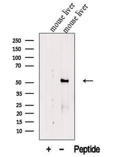 FTCD / 58K Golgi Protein Antibody - Western blot analysis of extracts of mouse liver tissue using FTCD antibody. The lane on the left was treated with blocking peptide.