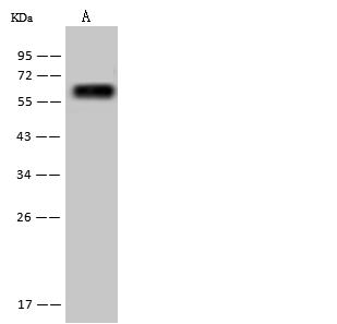 FTCD / 58K Golgi Protein Antibody - Anti-FTCD rabbit polyclonal antibody at 1:500 dilution. Lane A: HepG2 Whole Cell Lysate. Lysates/proteins at 30 ug per lane. Secondary: Goat Anti-Rabbit IgG (H+L)/HRP at 1/10000 dilution. Developed using the ECL technique. Performed under reducing conditions. Predicted band size: 59 kDa. Observed band size: 59 kDa.