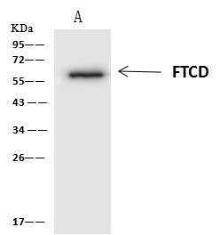 FTCD / 58K Golgi Protein Antibody - FTCD was immunoprecipitated using: Lane A: 0.5 mg HepG2 Whole Cell Lysate. 4 uL anti-FTCD rabbit polyclonal antibody and 60 ug of Immunomagnetic beads Protein A/G. Primary antibody: Anti-FTCD rabbit polyclonal antibody, at 1:100 dilution. Secondary antibody: Clean-Blot IP Detection Reagent (HRP) at 1:1000 dilution. Developed using the ECL technique. Performed under reducing conditions. Predicted band size: 59 kDa. Observed band size: 59 kDa.