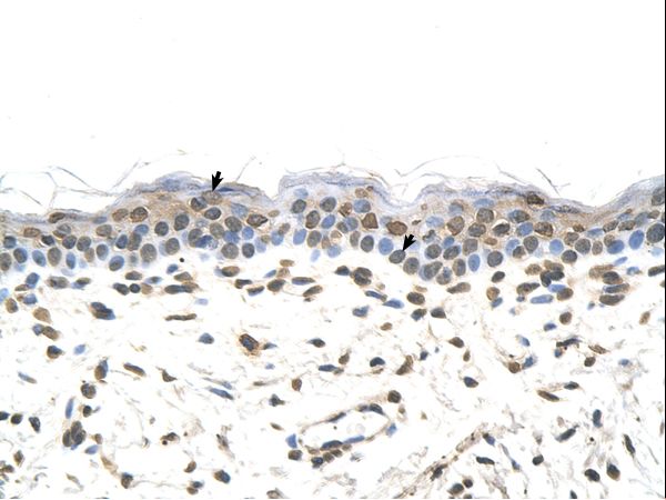 FTCD / 58K Golgi Protein Antibody - FTCD antibody FTCD(formiminotransferase cyclodeaminase) Antibody was used in IHC to stain formalin-fixed, paraffin-embedded human skin.  This image was taken for the unconjugated form of this product. Other forms have not been tested.