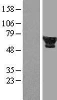 FTCD / 58K Golgi Protein Protein - Western validation with an anti-DDK antibody * L: Control HEK293 lysate R: Over-expression lysate