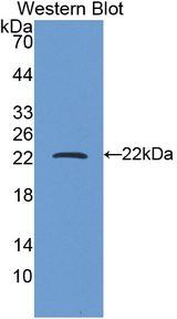 FTH1 / Ferritin Heavy Chain Antibody