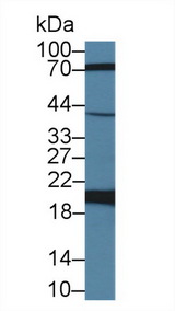 FTH1 / Ferritin Heavy Chain Antibody