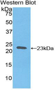 FTH1 / Ferritin Heavy Chain Antibody - Western blot of recombinant Ferritin Heavy Chain / FTH1.  This image was taken for the unconjugated form of this product. Other forms have not been tested.