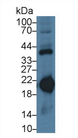 FTH1 / Ferritin Heavy Chain Antibody