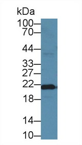 FTH1 / Ferritin Heavy Chain Antibody